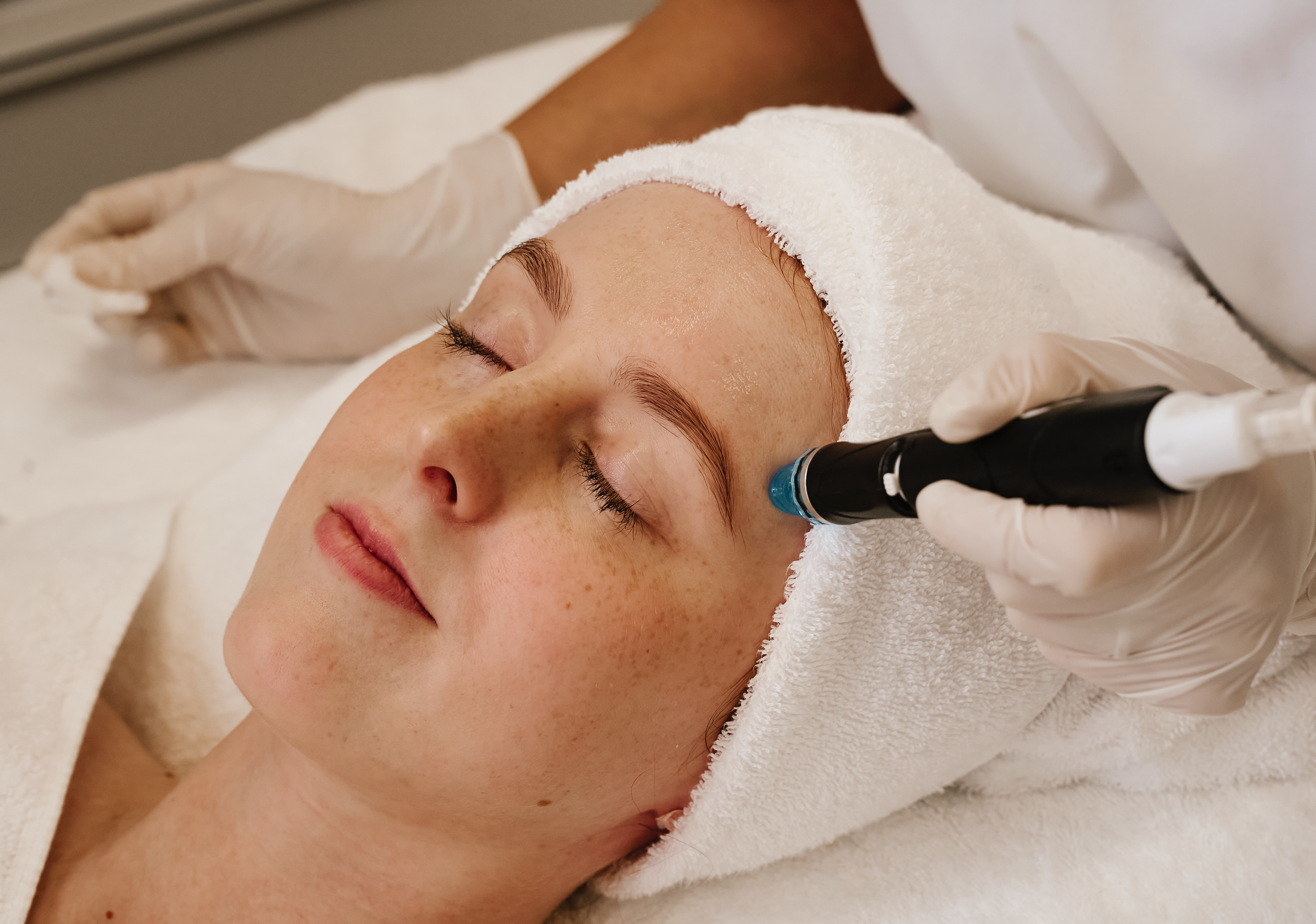 Hydrafacial Behandlung mit Salicylsäure zur Porenreinigung in München
