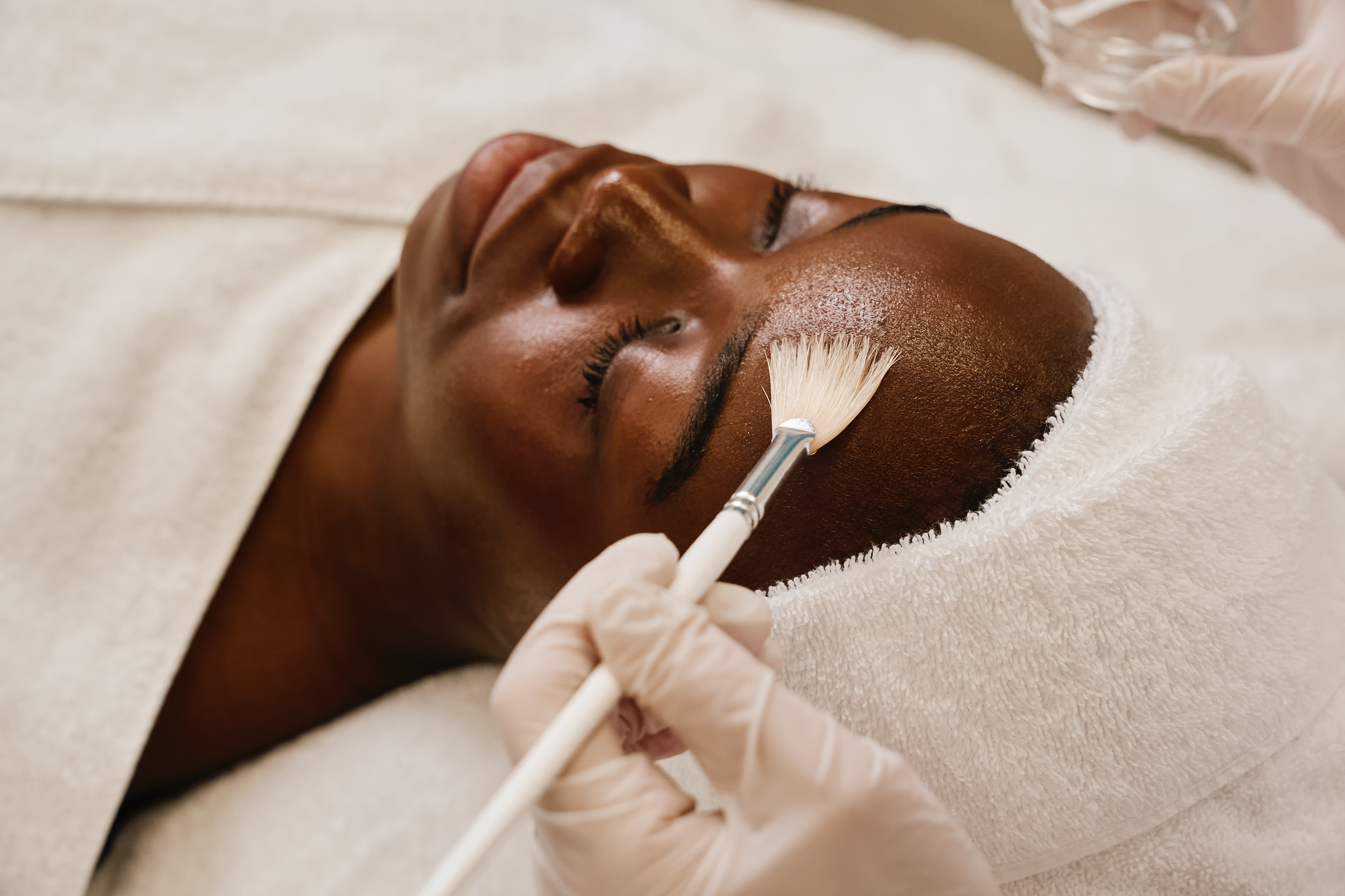 Vorbereitung der Haut auf das chemische Peeling