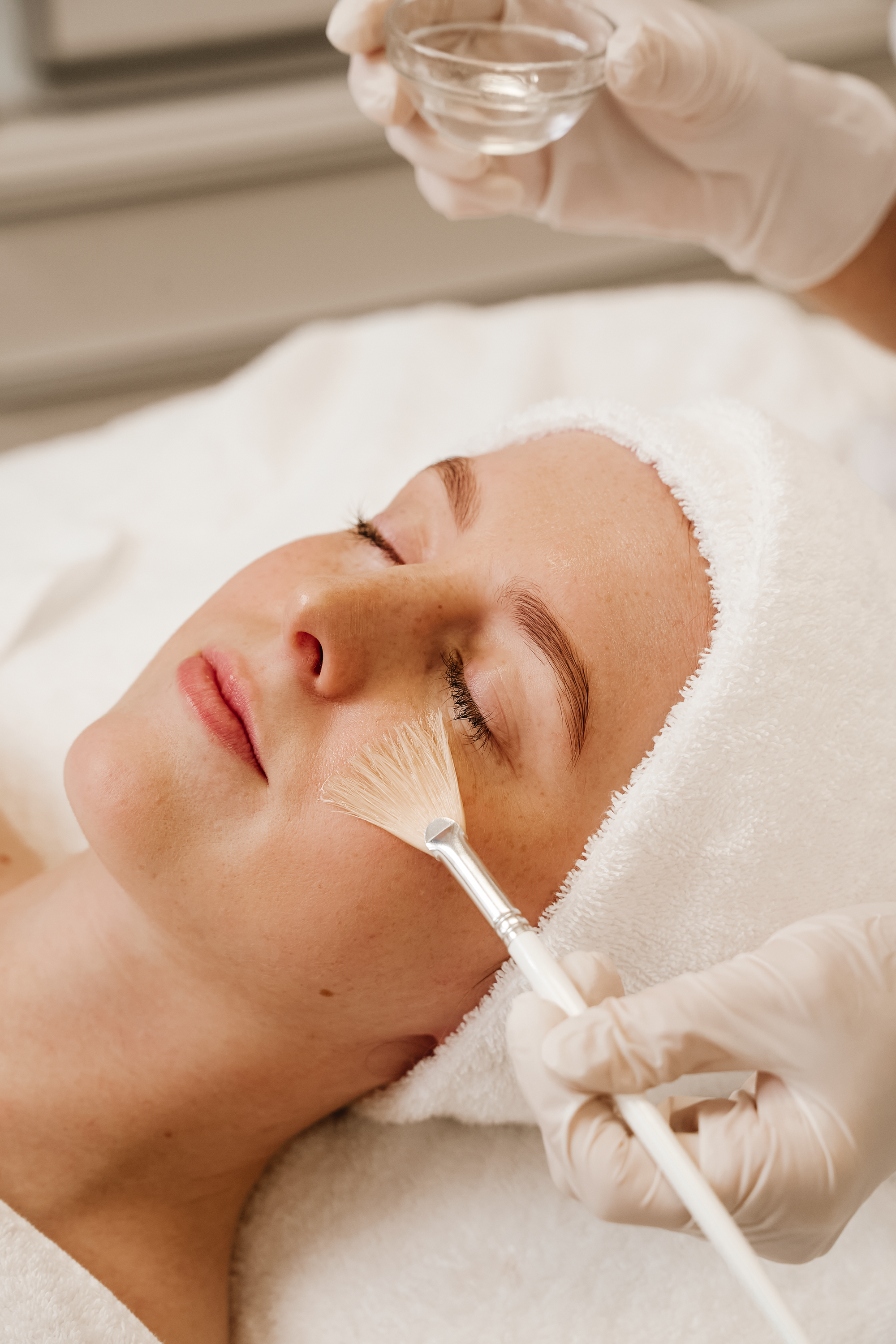 Professionelle Fruchtsäurebehandlung zur sanften Hauterneuerung