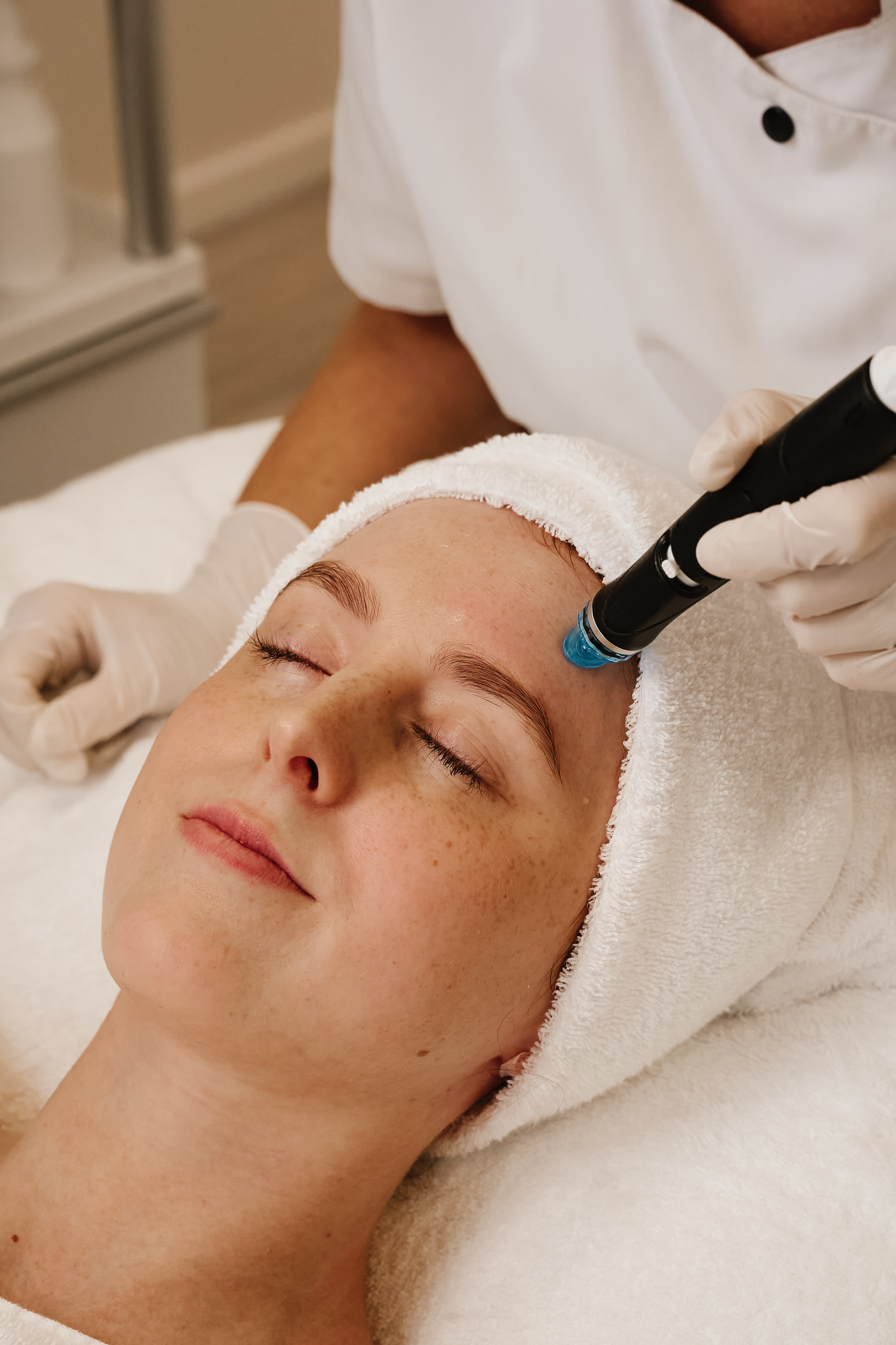 Reinigung und Exfoliation der Haut beim Hydrafacial in München