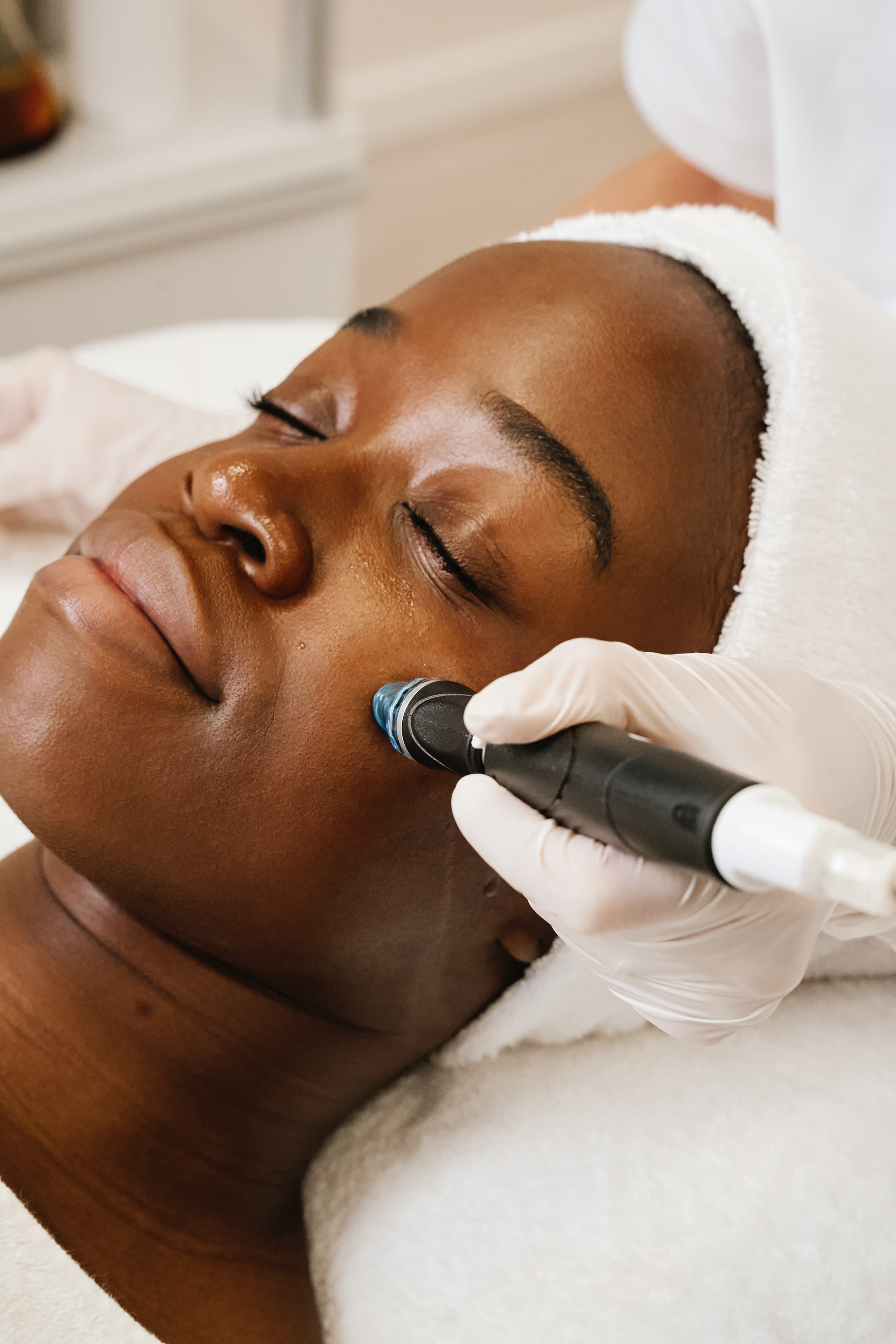 Ausreinigen verstopfter Poren mit Hydrafacial in München