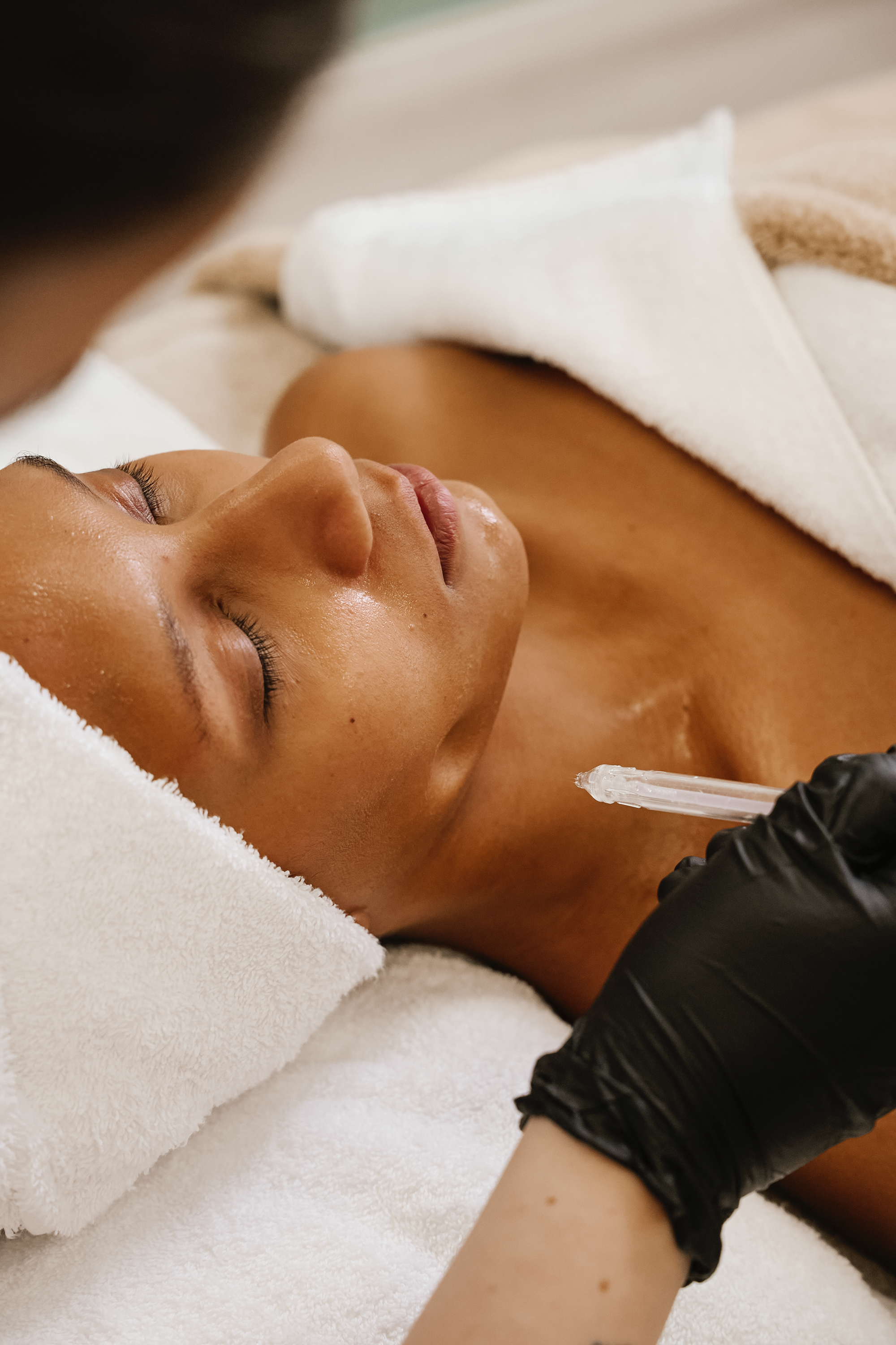 jetpeel-gesichtsbehandlung-muenchen