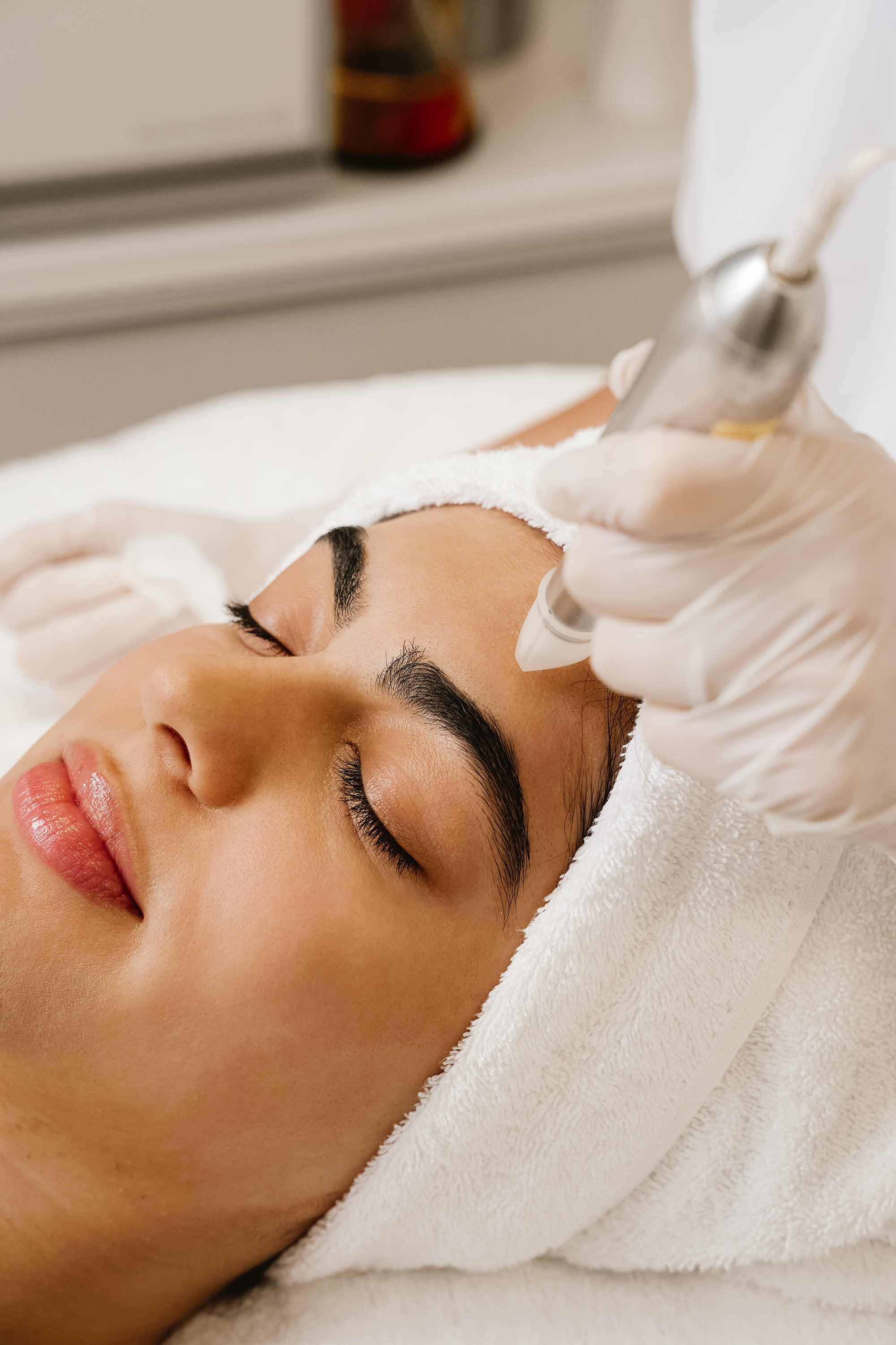 Microneedling Behandlung zur Hautregeneration bei Dermakosmetik München