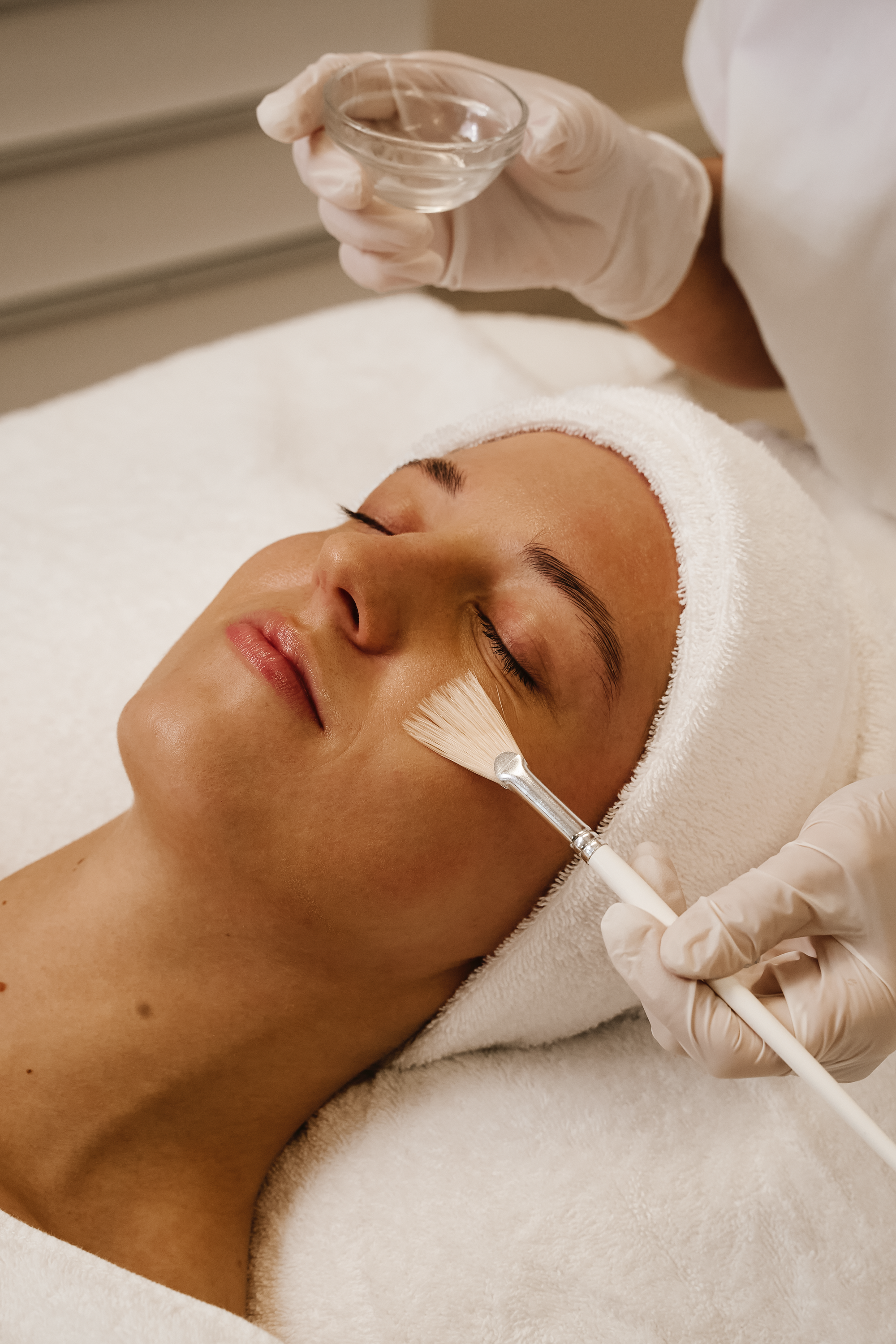 Enzym-Peeling als Vorbereitung für Microneedling in München