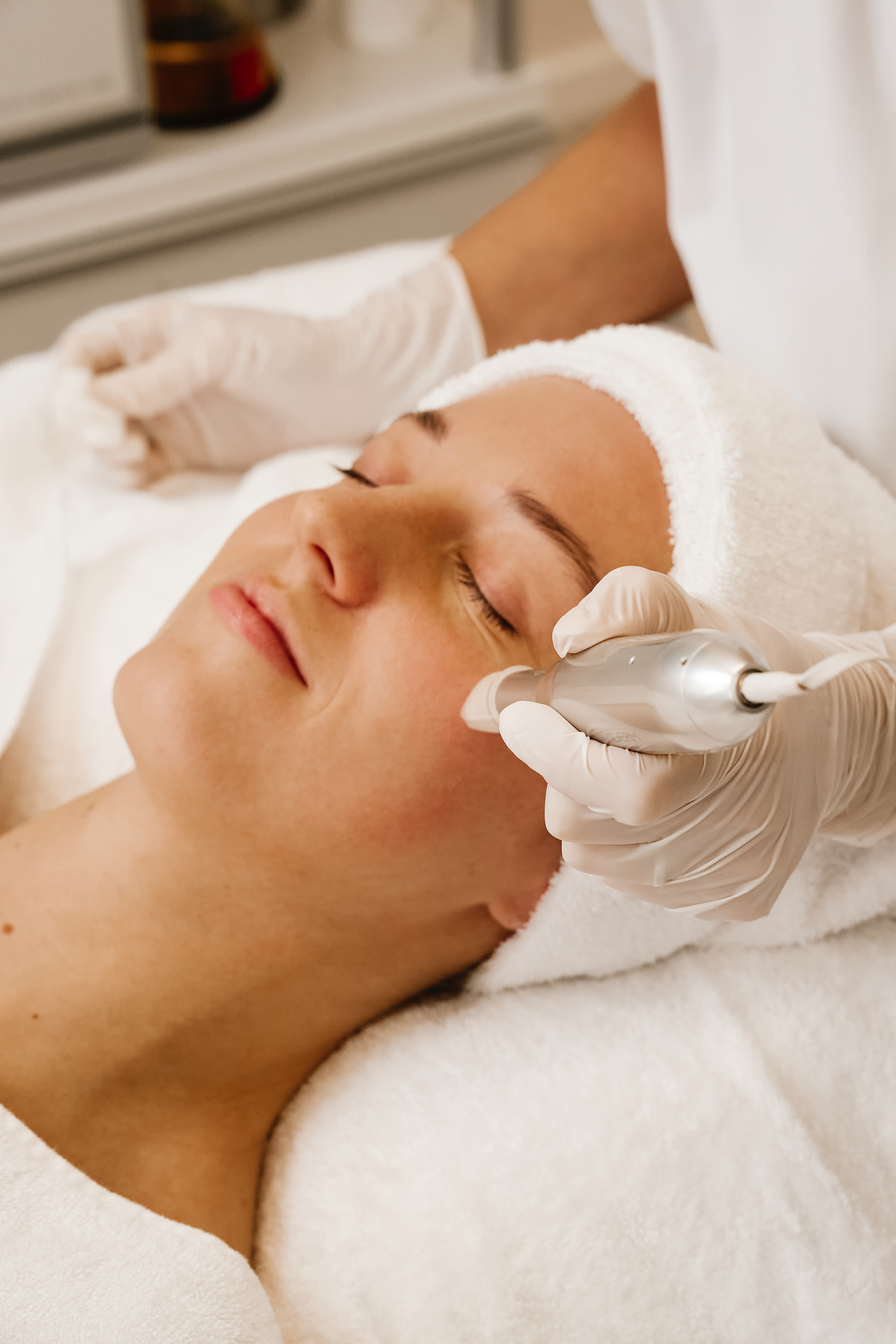 Gründliche Reinigung der Haut vor dem Microneedling in München