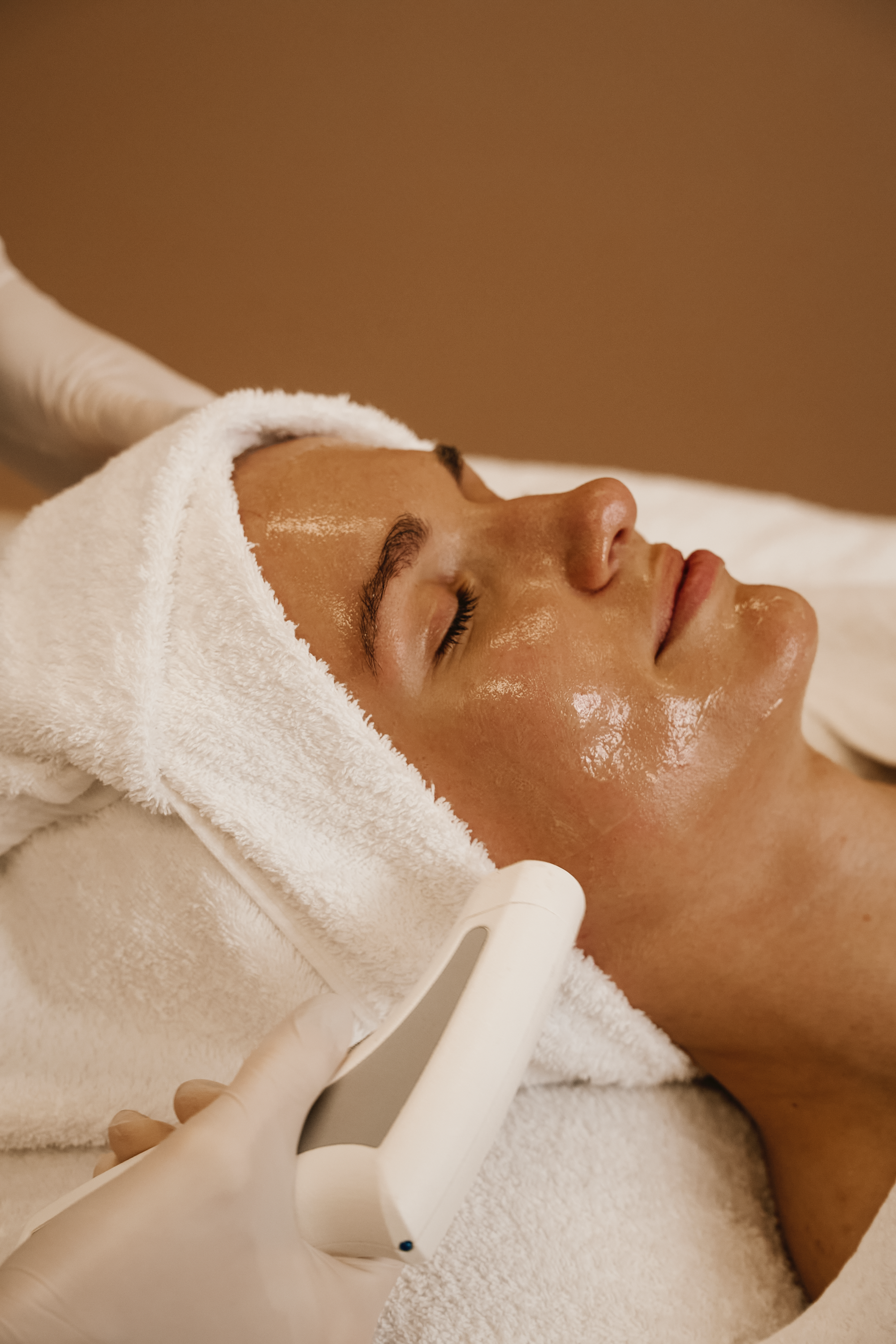 Skin Needler mit ultrafeinen Nadeln bei Microneedling Behandlung in München